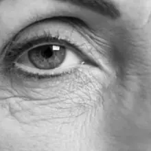 Anti Ageing